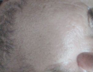 Skin Issues