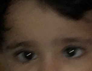 Squint Eyes