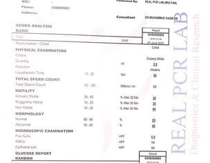 Superm Motility Issue