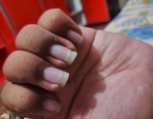 Yeh Kia Masla Ha Nail Ko