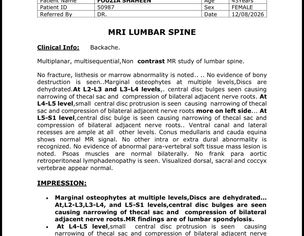 Need Advice: Can Lumbar Disc Bulges Be Treated Without Surgery?