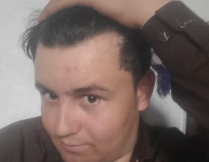 Hairfall