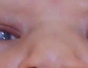 EYES CLOUDINESS
