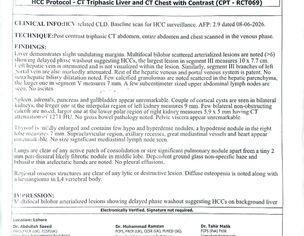 Is Treatment In Alopathy Possible For HCC Liver? According Reports Which Is Best Treatment??