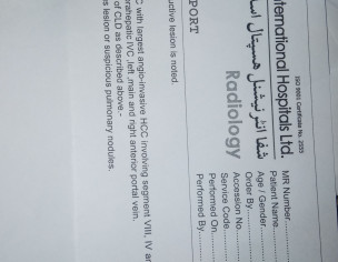 Liver Cancer