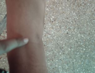 Night Leg Pain Specially In Legs And Foot Joint