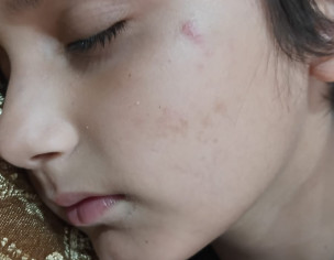 Skin Issue