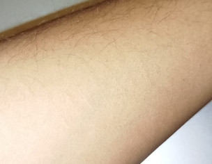 Blade Scars