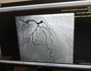 Heart Issue