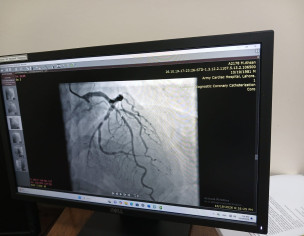 Heart Issue