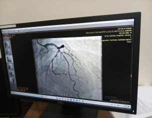 Heart Issue