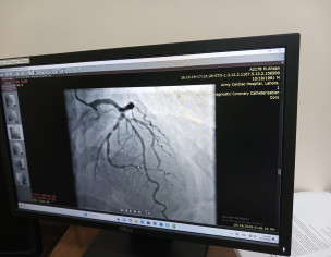 Heart Issue
