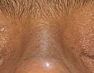 Eyes Issue