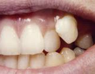 Dental Procedures 