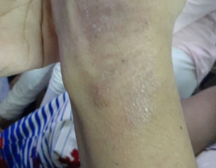 Skin Problem