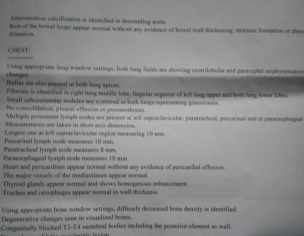 Stomach Cancer