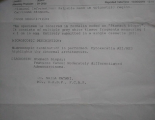 Stomach Cancer