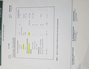 Nil Sperm, High FSH And Cyst