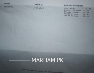 Tsh Serum Test