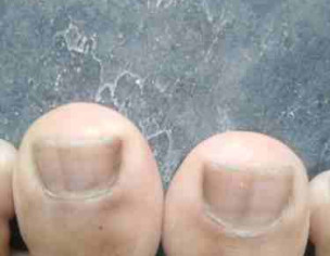 Nail Colour