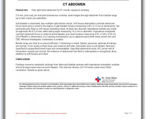 CA Gallbladder
