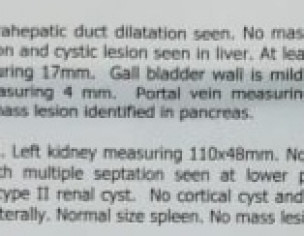 Kidney Cyst