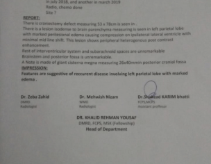 Brain Tumor