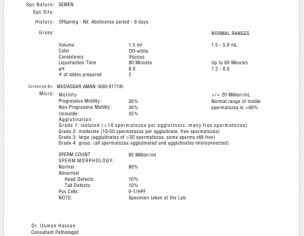 Sperm Motility/infertility/vericocele 