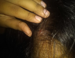 Scalp Problem