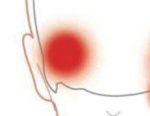 Pain At Lower Left Side Of Head