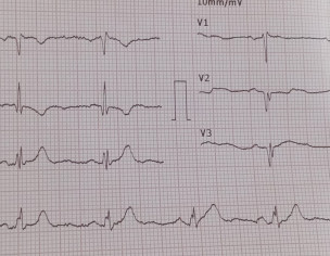 Advice From Cardiologist