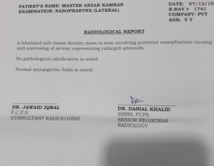 Enlarge Adenoid 