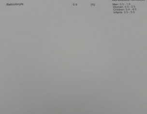 Anemia Unspecified