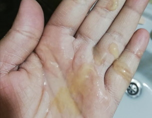 Yellow Sperm
