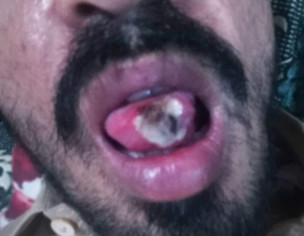Oral And Skin 
