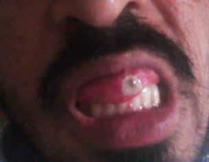 Oral And Skin 