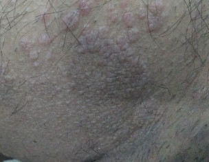 Allergy And Itching