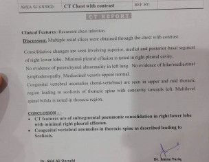 Heavy Oral And Nasal Bleeding
