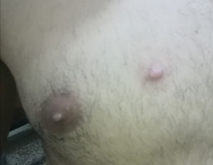 Dermatologist 