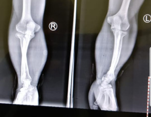 Bone Deformities 