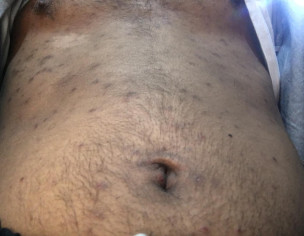 Skin Problem