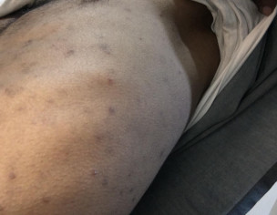 Skin Problem
