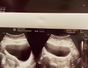 Gynae/obstetric
