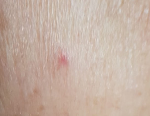 Dermatoloist