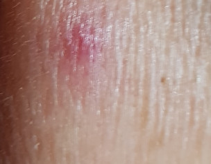 Dermatoloist