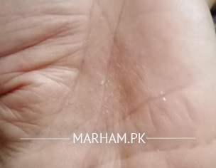 Skin Problem 
