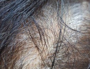 Dermatoloist