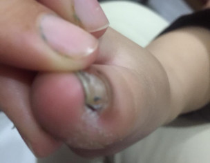 Skin Problem 