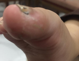 Skin Problem 