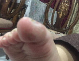 Skin Problem 